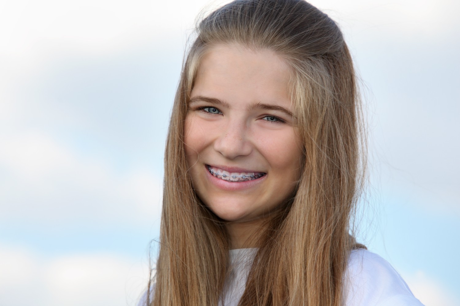 teen girl with braces